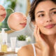 Acne-Causes-Treatments