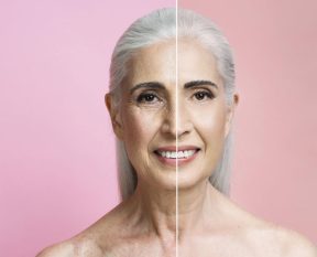 Skin Aging