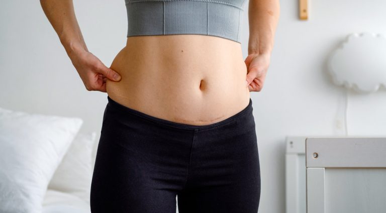 lose_belly_fat_fast